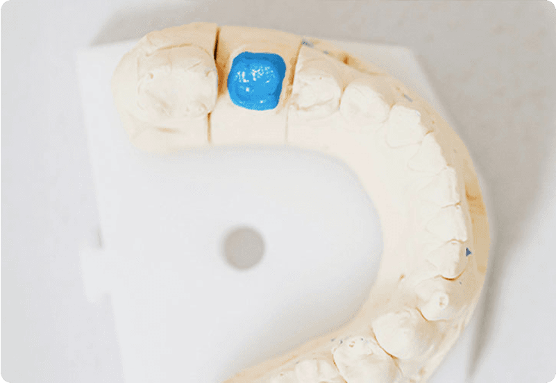 dental crown hero image