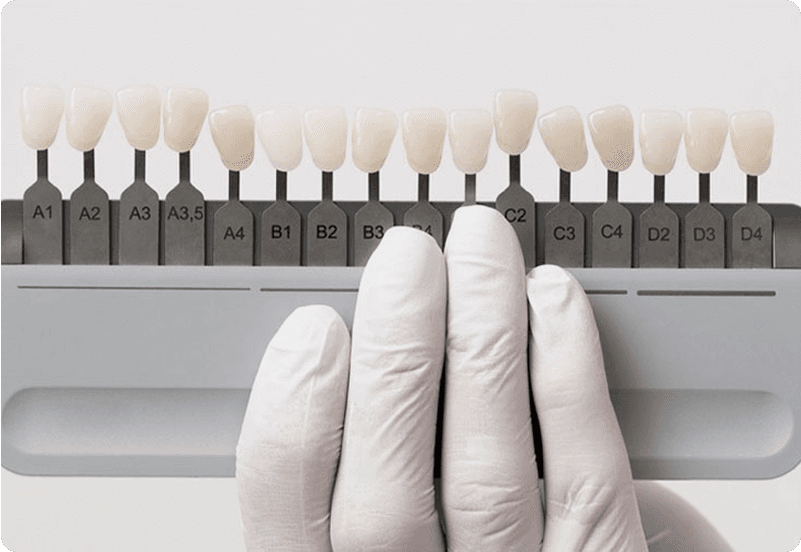 dental implant hero image