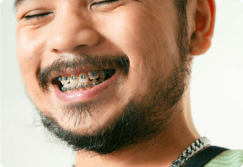 teeth cleaning hero image