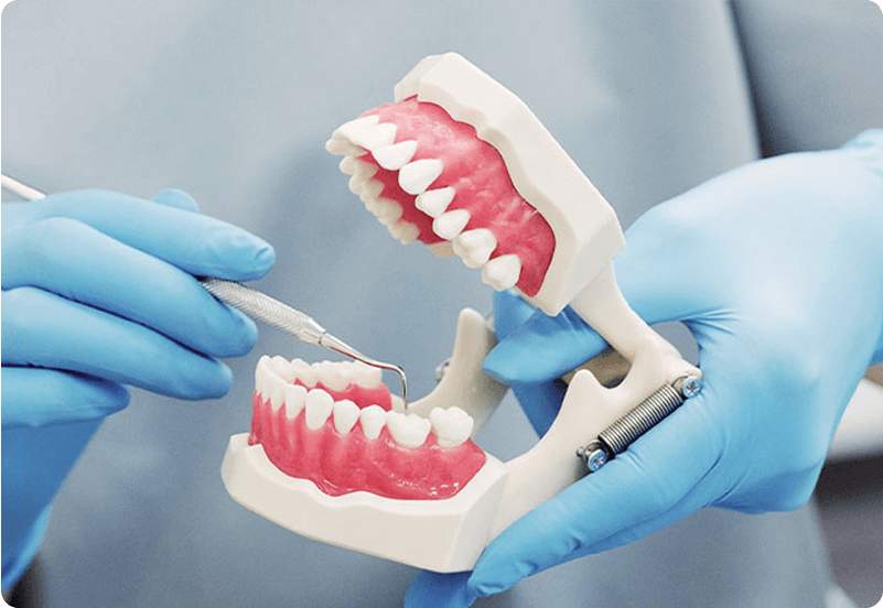 tooth extraction image